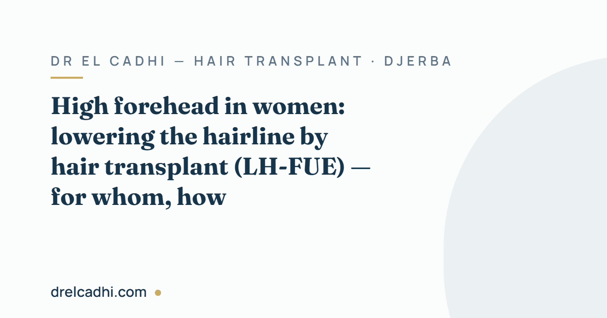 Title card for the article "High forehead in women: lowering the hairline by hair transplant (LH-FUE) — for whom, how" — drelcadhi.com
