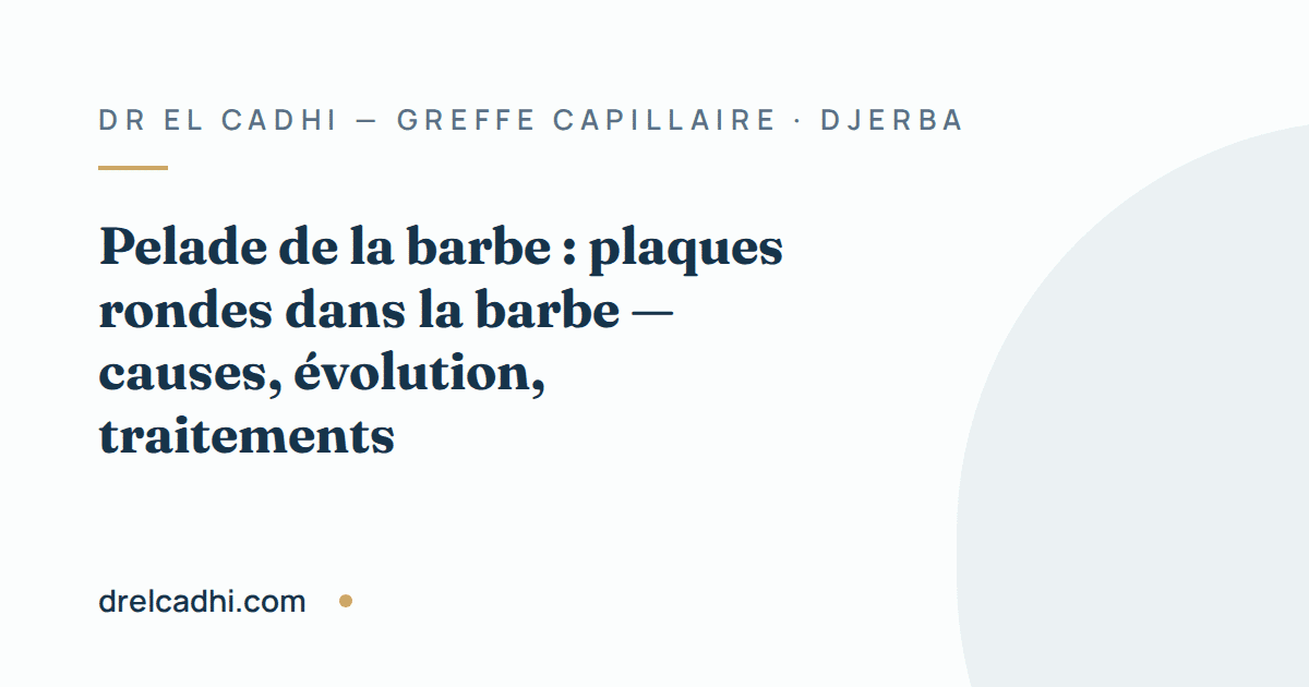 Illustration titrée de l’article « Pelade de la barbe : plaques rondes dans la barbe — causes, évolution, traitements »