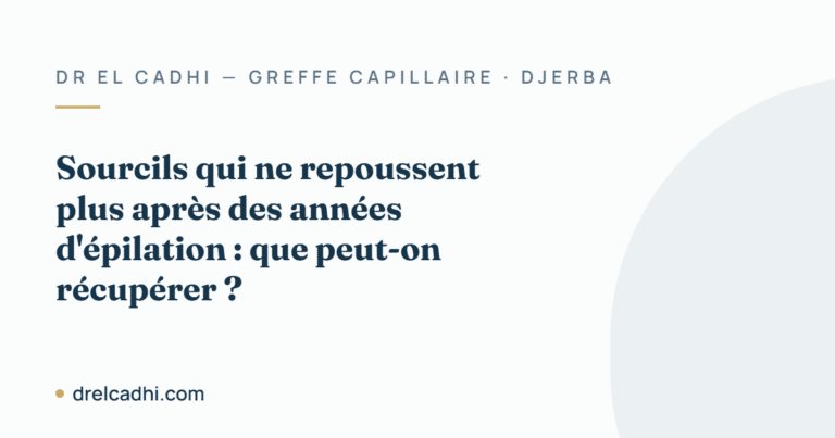 Illustration titrée de l’article « Sourcils qui ne repoussent plus après des années d'épilation : que peut-on récupérer ? »