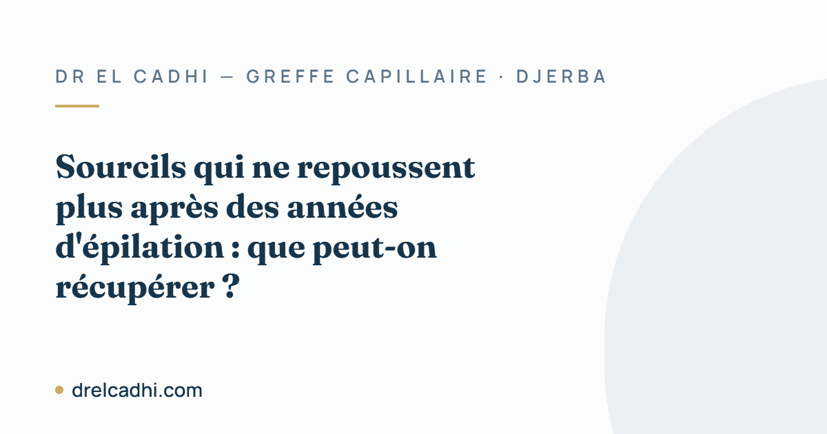 Illustration titrée de l’article « Sourcils qui ne repoussent plus après des années d'épilation : que peut-on récupérer ? »