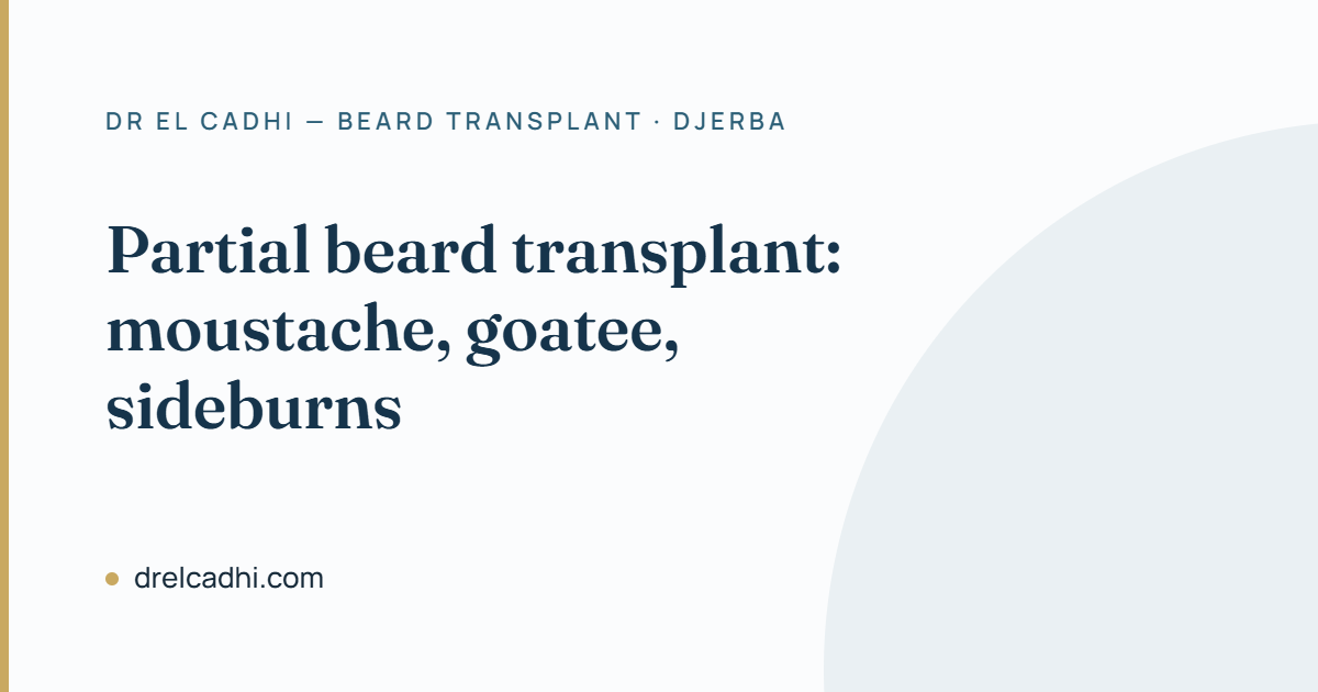 Goatee transplant, moustache or sideburns: one beard area, not the whole beard
